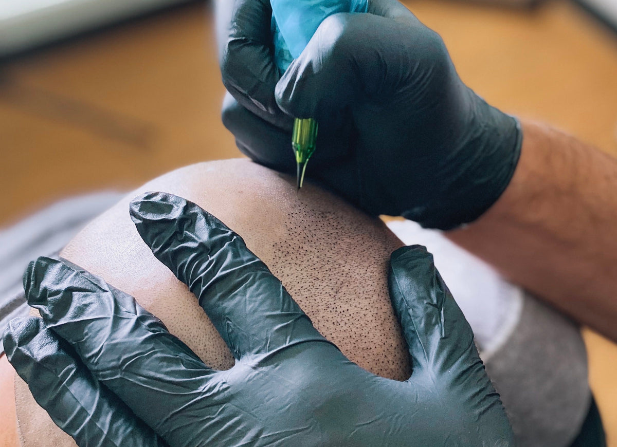 Why scalp micropigmentation fades, and how to fight it