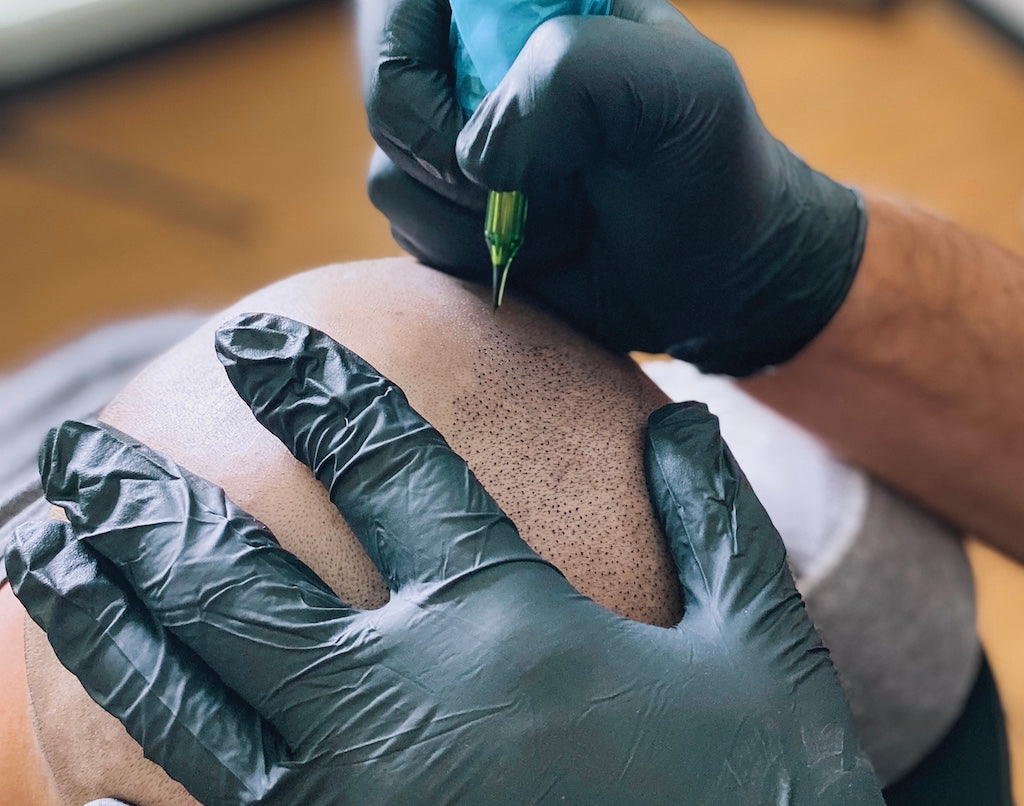 Always Do Your Research Before You Get A Scalp Tattoo