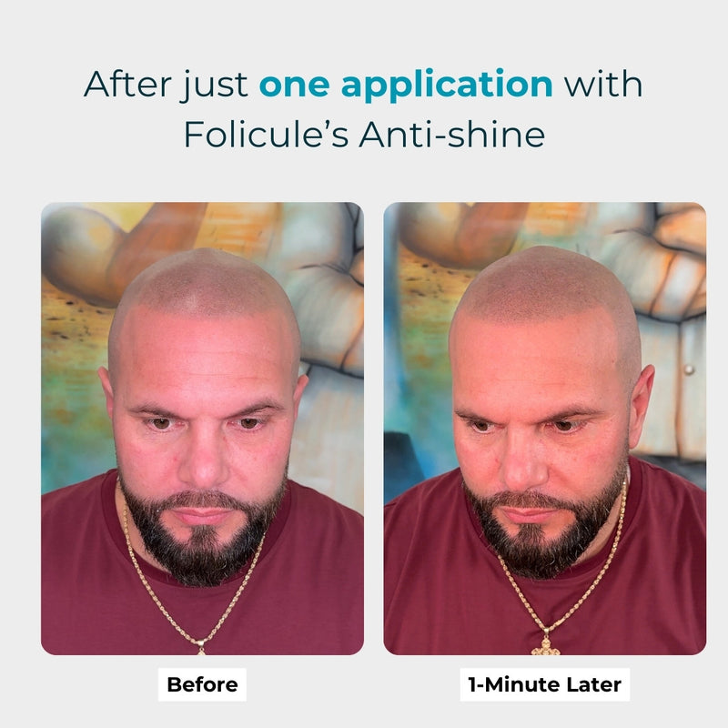 scalp anti-shine bald head shine