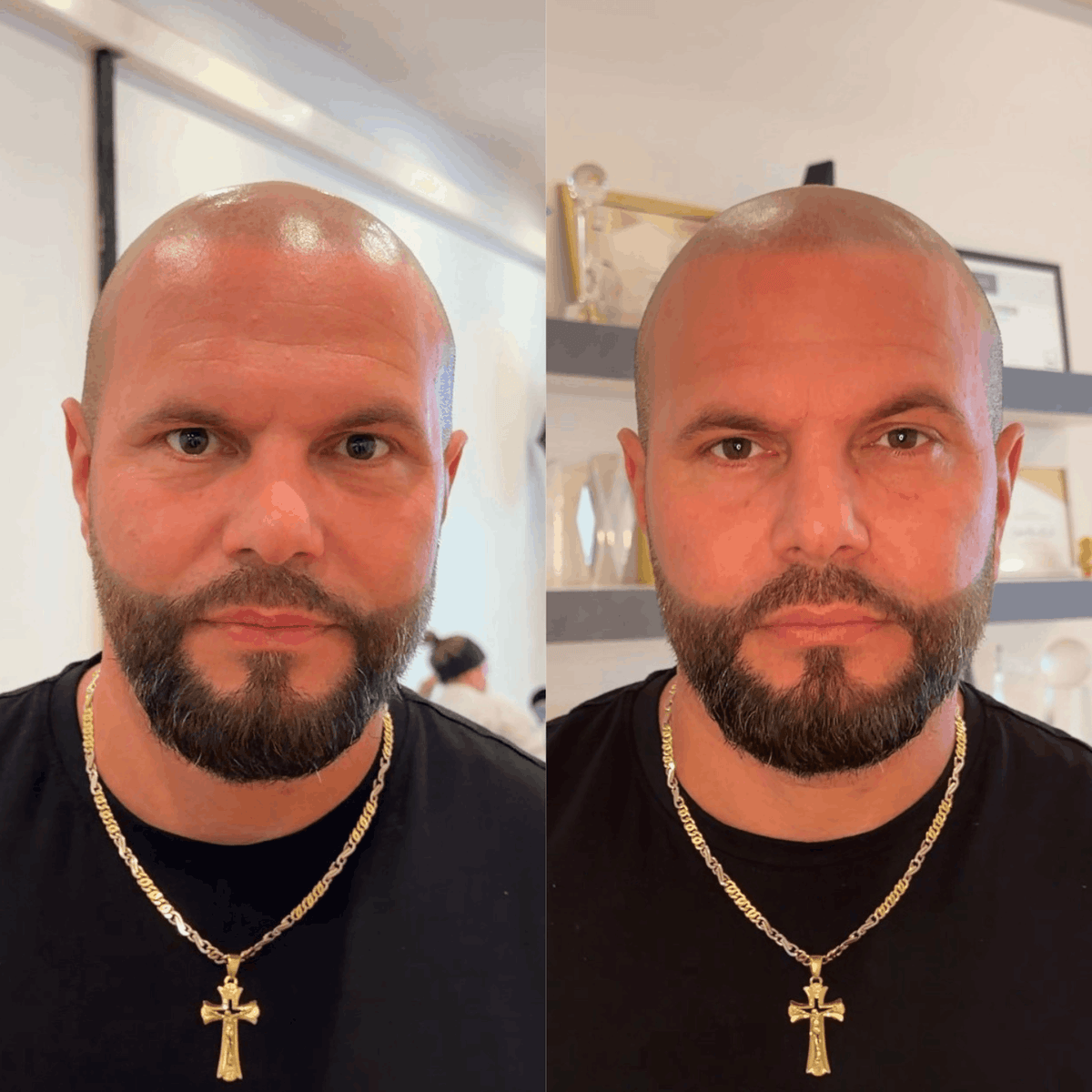 Shine Slayer before and after on a shaved head, same lighting